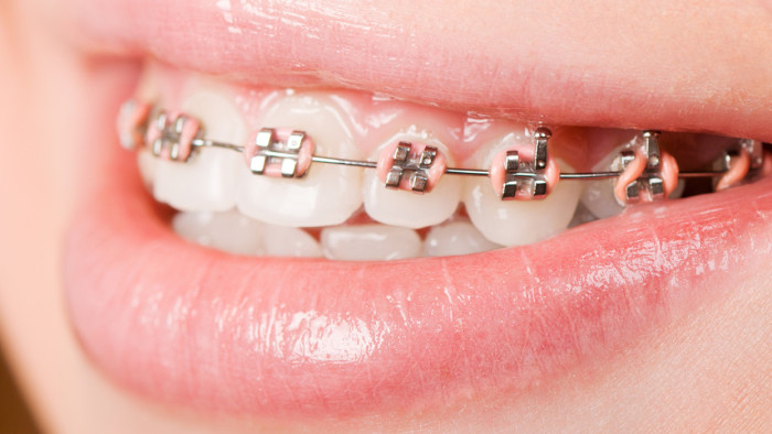 Orthodontics