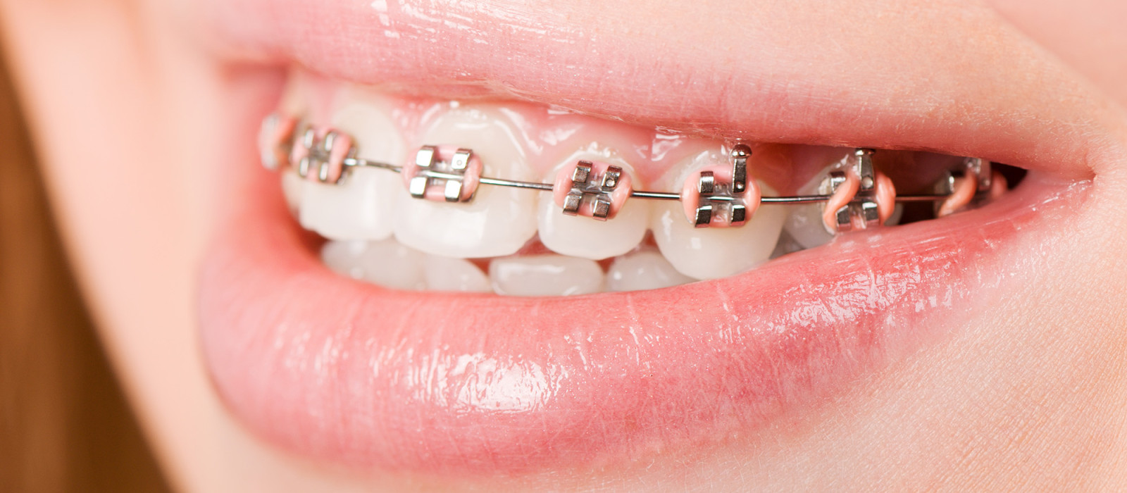 Orthodontics